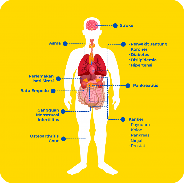 anatomy obesity
