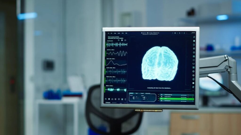 Animator Pinot Terserang Stroke, Ketahui 7 Faktor Risiko Penyakit Ini
