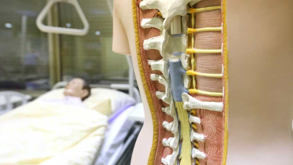 Dari-Kelumpuhan-hingga-Depresi-Inilah-Bahaya-Spinal-Cord-Injury